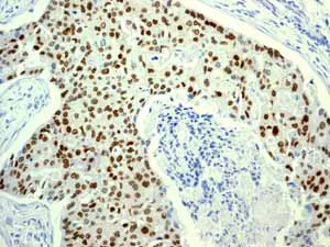 Immunohistochemistry (Formalin/PFA-fixed paraffin-embedded sections) - Anti-Estrogen Receptor alpha antibody [EPR4097] - BSA and Azide free (AB167610)