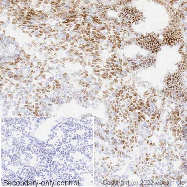 Immunohistochemistry (Frozen sections) - Anti-Estrogen Receptor alpha antibody [EPR4097] - BSA and Azide free (AB167610)