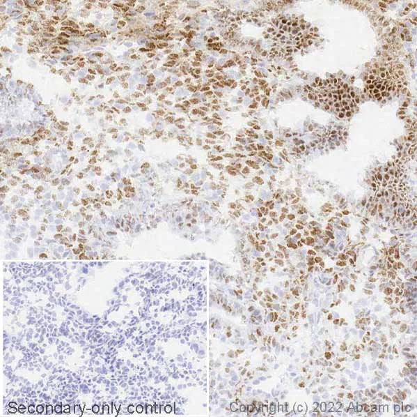 Immunohistochemistry (Frozen sections) - Anti-Estrogen Receptor alpha antibody [EPR4097] - BSA and Azide free (AB167610)