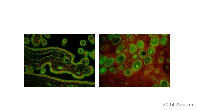 Anti-Estrogen Receptor alpha antibody [EPR703(2)]