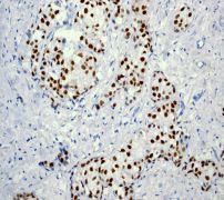 Immunohistochemistry (Formalin/PFA-fixed paraffin-embedded sections) - Anti-Estrogen Receptor alpha antibody [EPR703(2)] - BSA and Azide free (AB214455)