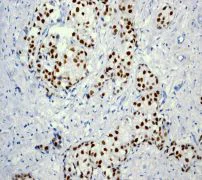 Immunohistochemistry (Formalin/PFA-fixed paraffin-embedded sections) - Anti-Estrogen Receptor alpha antibody [EPR703(2)] - BSA and Azide free (AB214455)