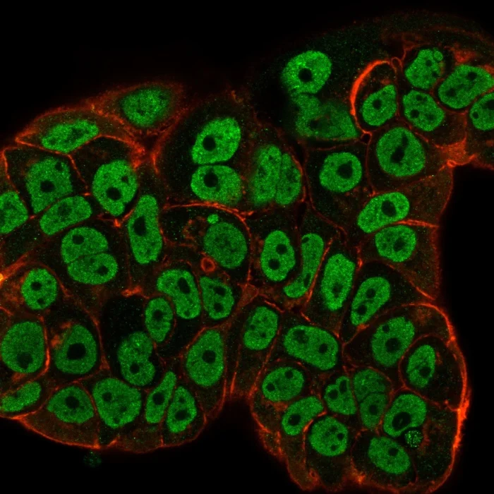 Immunocytochemistry/ Immunofluorescence - Anti-Estrogen Receptor alpha antibody [ESR1/3557] - BSA and Azide free (AB259430)
