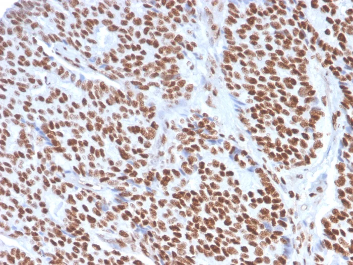 Immunohistochemistry (Formalin/PFA-fixed paraffin-embedded sections) - Anti-Estrogen Receptor alpha antibody [ESR1/3557] - BSA and Azide free (AB259430)