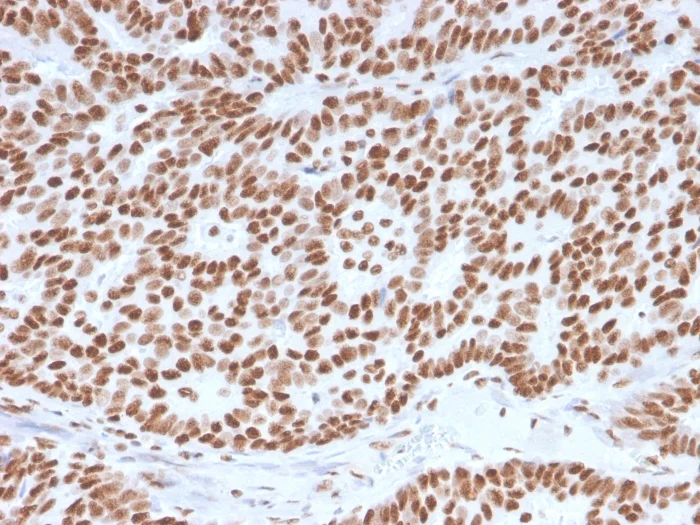 Immunohistochemistry (Formalin/PFA-fixed paraffin-embedded sections) - Anti-Estrogen Receptor alpha antibody [ESR1/3557] - BSA and Azide free (AB259430)