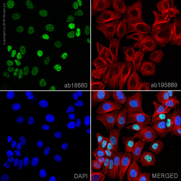 Immunocytochemistry/ Immunofluorescence - Anti-Estrogen Receptor alpha antibody [SP1] (AB16660), expandable thumbnail