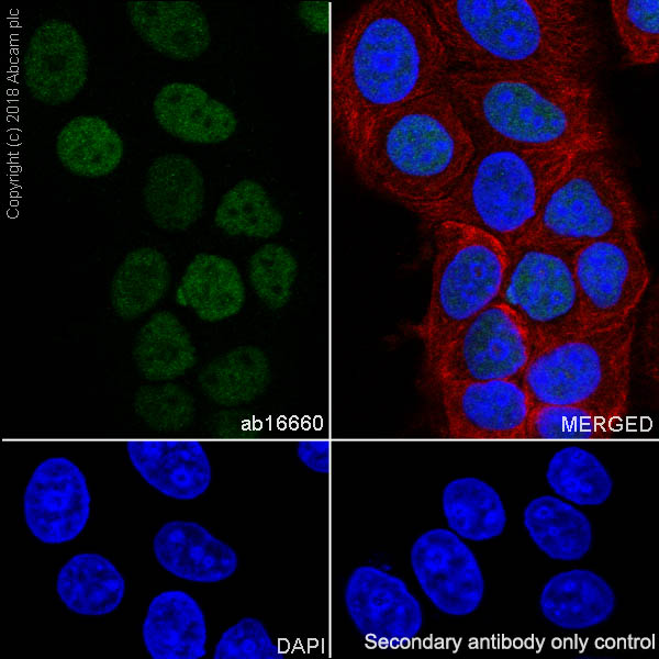 Immunocytochemistry/ Immunofluorescence - Anti-Estrogen Receptor alpha antibody [SP1] (ab16660), expandable thumbnail