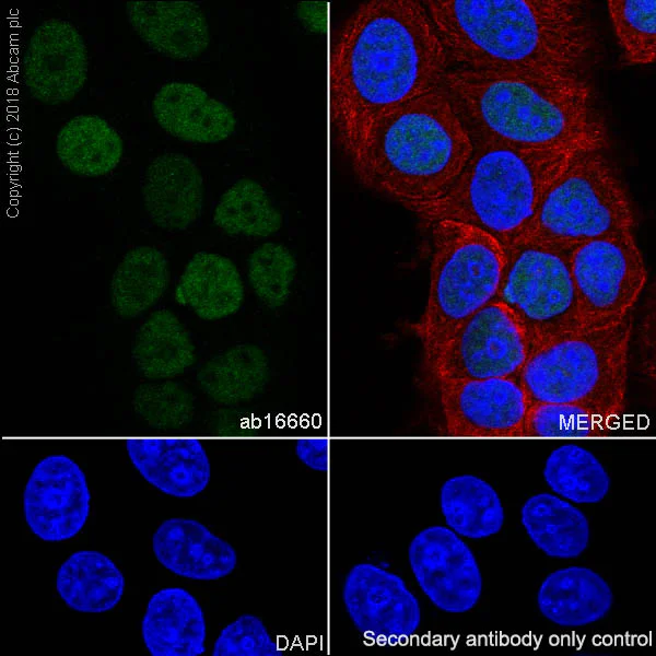 Immunocytochemistry/ Immunofluorescence - Anti-Estrogen Receptor alpha antibody [SP1] (AB16660)