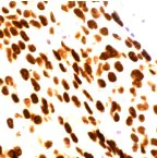 Immunohistochemistry (Formalin/PFA-fixed paraffin-embedded sections) - Anti-Estrogen Receptor alpha antibody [SP1] (AB16660)