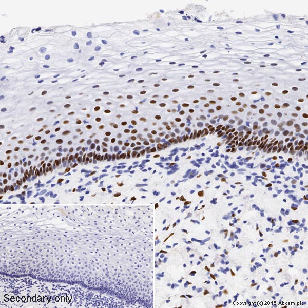 Immunohistochemistry (Formalin/PFA-fixed paraffin-embedded sections) - Anti-Estrogen Receptor alpha antibody [SP1] (AB16660), expandable thumbnail
