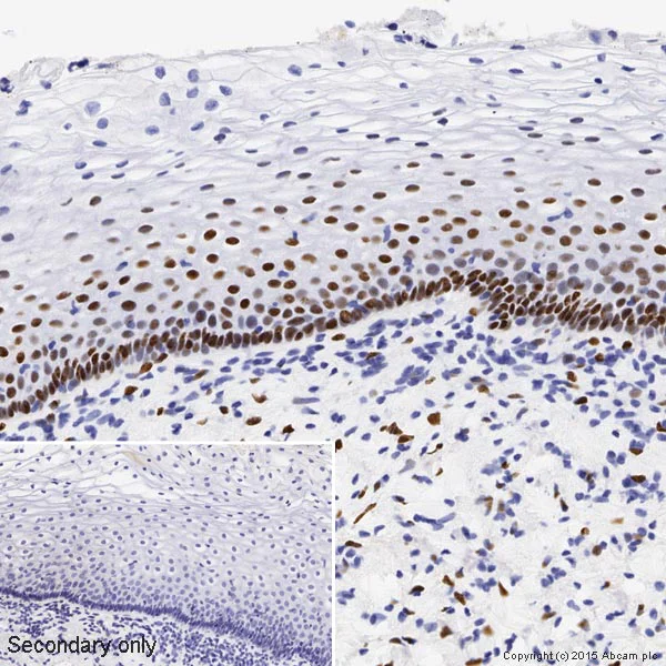 Immunohistochemistry (Formalin/PFA-fixed paraffin-embedded sections) - Anti-Estrogen Receptor alpha antibody [SP1] (AB16660)