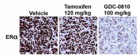 Immunohistochemistry (Formalin/PFA-fixed paraffin-embedded sections) - Anti-Estrogen Receptor alpha antibody [SP1] (AB16660), expandable thumbnail