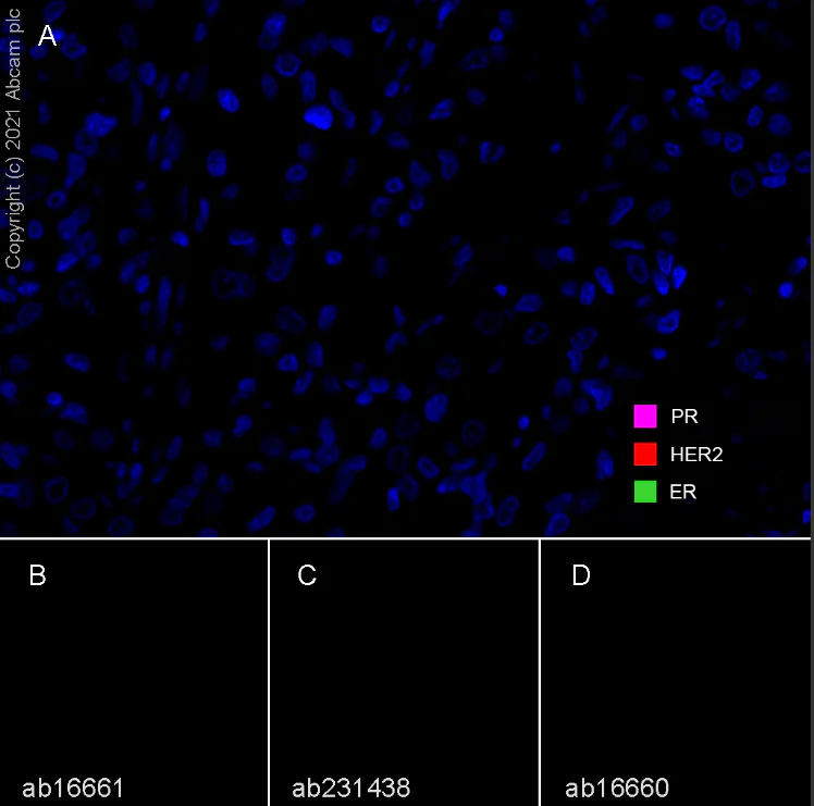 Multiplex immunohistochemistry - Anti-Estrogen Receptor alpha antibody [SP1] (AB16660)