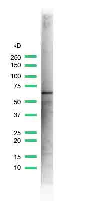 Western blot - Anti-Estrogen Receptor alpha antibody [SP1] (AB16660), expandable thumbnail