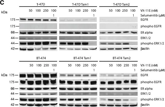 Western blot - Anti-Estrogen Receptor alpha antibody [SP1] (AB16660)
