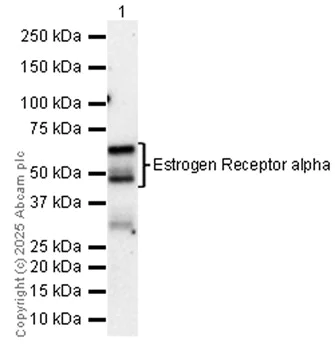 Western blot - Anti-Estrogen Receptor alpha antibody [SP1] (AB16660)