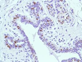 Immunohistochemistry (Formalin/PFA-fixed paraffin-embedded sections) - Anti-Estrogen Receptor alpha antibody [SP1] - BSA and Azide free (ab187260), expandable thumbnail