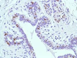 Immunohistochemistry (Formalin/PFA-fixed paraffin-embedded sections) - Anti-Estrogen Receptor alpha antibody [SP1] - BSA and Azide free (AB187260)