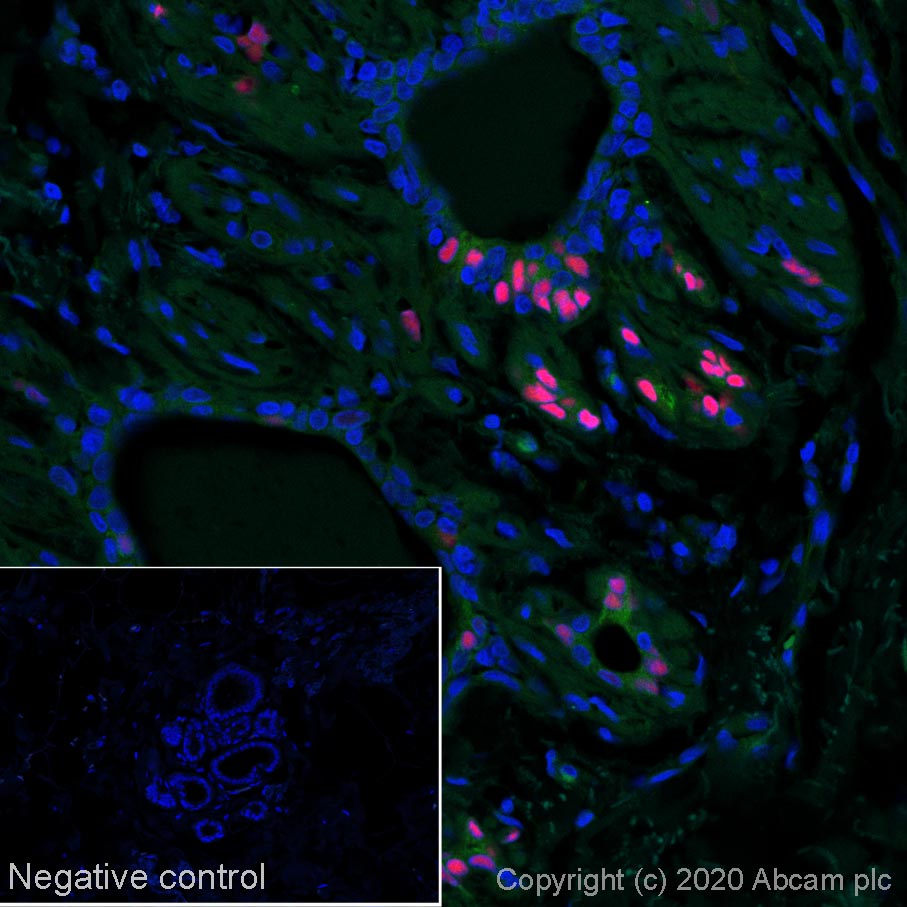 Immunohistochemistry (Formalin/PFA-fixed paraffin-embedded sections) - Anti-Estrogen Receptor alpha antibody [SP1] - BSA and Azide free (AB187260), expandable thumbnail