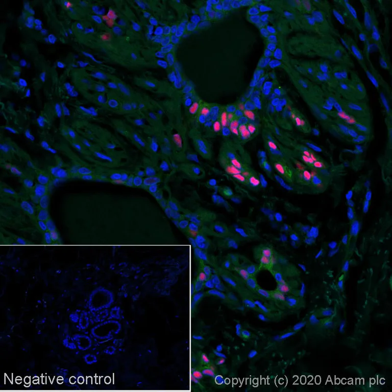 Immunohistochemistry (Formalin/PFA-fixed paraffin-embedded sections) - Anti-Estrogen Receptor alpha antibody [SP1] - BSA and Azide free (AB187260)
