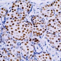 Immunohistochemistry (Formalin/PFA-fixed paraffin-embedded sections) - Anti-Estrogen Receptor alpha antibody [SP1] - BSA and Azide free (ab187260), expandable thumbnail