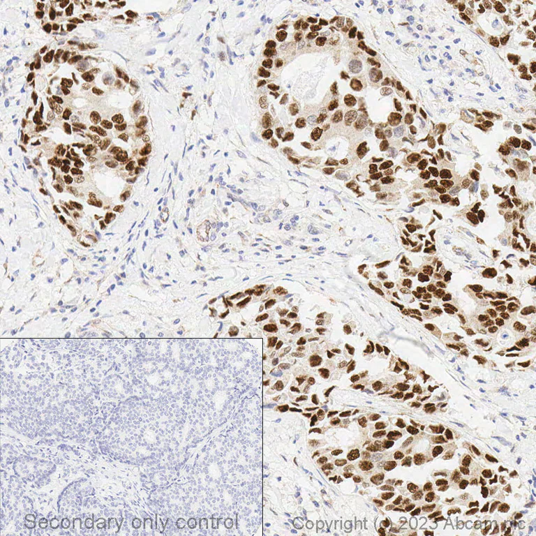 Immunohistochemistry (Formalin/PFA-fixed paraffin-embedded sections) - Anti-Estrogen Receptor alpha antibody [SP1] - BSA and Azide free (AB187260)