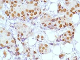 Immunohistochemistry (Formalin/PFA-fixed paraffin-embedded sections) - Anti-Estrogen Receptor alpha antibody [SP1] - BSA and Azide free (AB187260)