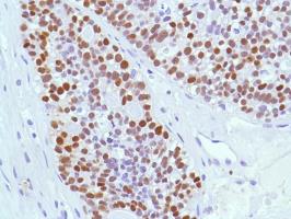 Immunohistochemistry (Formalin/PFA-fixed paraffin-embedded sections) - Anti-Estrogen Receptor alpha antibody [SP1] - BSA and Azide free (AB187260), expandable thumbnail