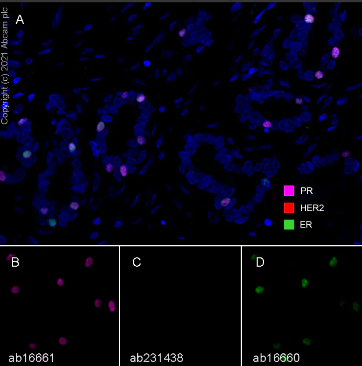 Multiplex immunohistochemistry - Anti-Estrogen Receptor alpha antibody [SP1] - BSA and Azide free (AB187260)