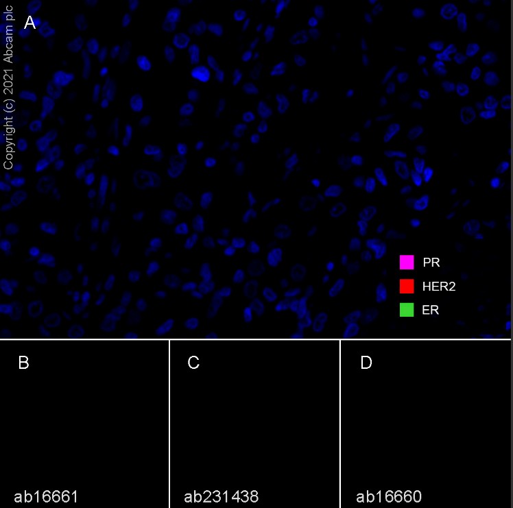 Multiplex immunohistochemistry - Anti-Estrogen Receptor alpha antibody [SP1] - BSA and Azide free (ab187260), expandable thumbnail