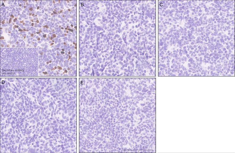 Immunohistochemistry (Formalin/PFA-fixed paraffin-embedded sections) - Anti-Estrogen Receptor alpha (mutated Y537S) antibody [EPR28709-53] - BSA and Azide free (AB316767)