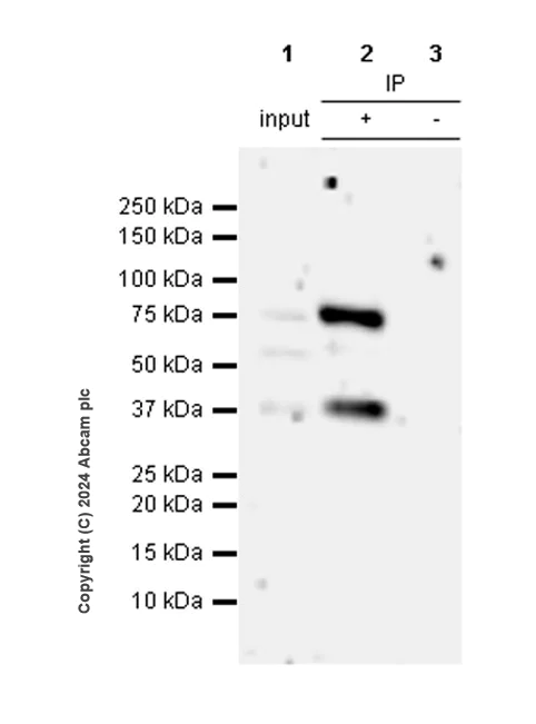Immunoprecipitation - Anti-Estrogen Receptor alpha (mutated Y537S) antibody [EPR28709-53] - BSA and Azide free (AB316767)