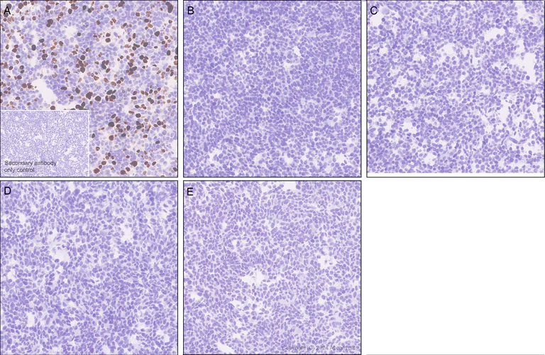 Immunohistochemistry (Formalin/PFA-fixed paraffin-embedded sections) - Anti-Estrogen Receptor alpha (mutated Y537S + D538G) antibody [EPR28709-35] (AB316764)