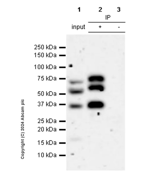 Immunoprecipitation - Anti-Estrogen Receptor alpha (mutated Y537S + D538G) antibody [EPR28709-35] (AB316764)