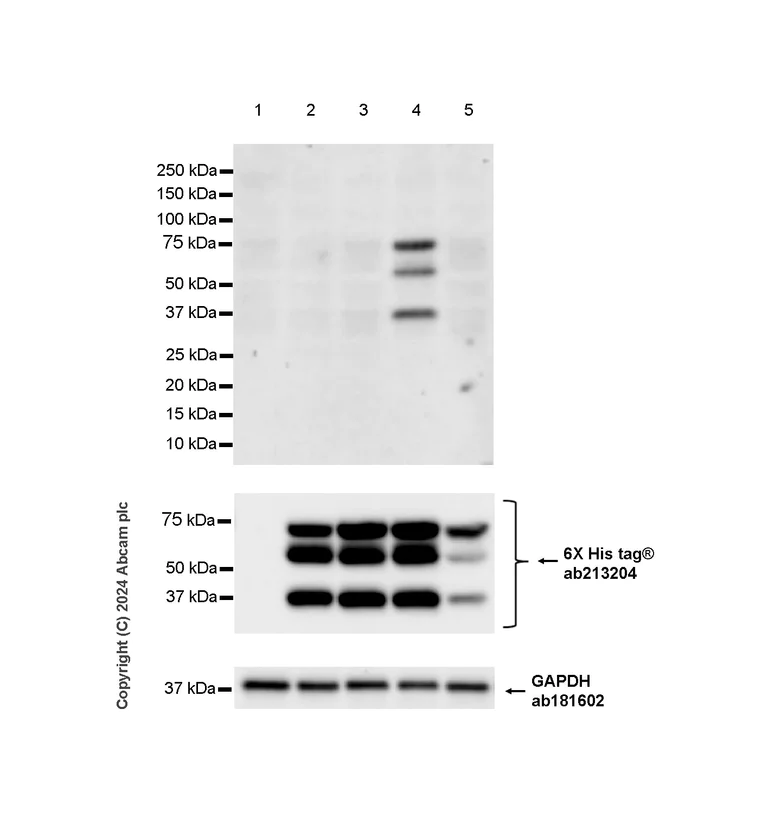 Western blot - Anti-Estrogen Receptor alpha (mutated Y537S + D538G) antibody [EPR28709-35] (AB316764)