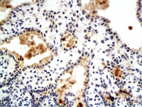 Immunohistochemistry (Formalin/PFA-fixed paraffin-embedded sections) - Anti-Estrogen Receptor alpha (phospho S104 + S106) antibody (AB269451)