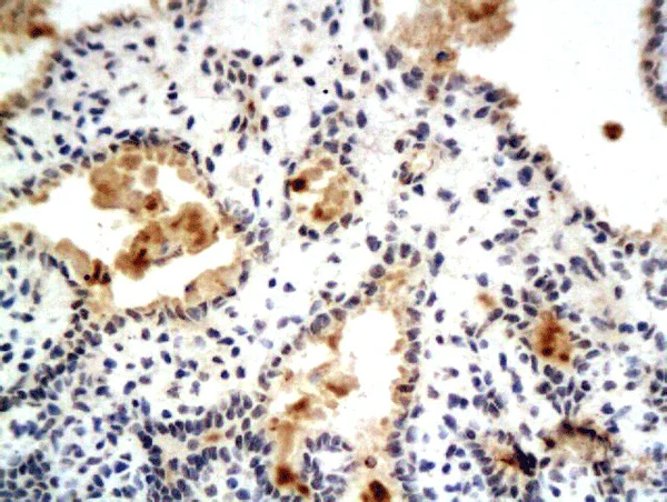 Immunohistochemistry (Formalin/PFA-fixed paraffin-embedded sections) - Anti-Estrogen Receptor alpha (phospho S104 + S106) antibody (AB269451)
