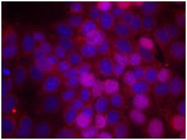Immunocytochemistry/ Immunofluorescence - Anti-Estrogen Receptor alpha (phospho S106) antibody (AB131111), expandable thumbnail