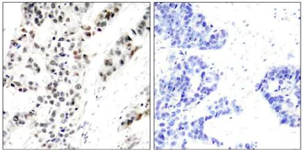 Immunohistochemistry (Formalin/PFA-fixed paraffin-embedded sections) - Anti-Estrogen Receptor alpha (phospho S106) antibody (AB131111)