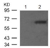 Western blot - Anti-Estrogen Receptor alpha (phospho S106) antibody (AB131111), expandable thumbnail