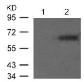 Western blot - Anti-Estrogen Receptor alpha (phospho S106) antibody (AB131111)