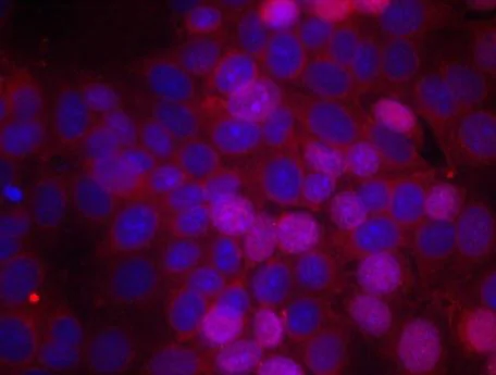 Immunocytochemistry/ Immunofluorescence - Anti-Estrogen Receptor alpha (phospho S106) antibody (AB194784)