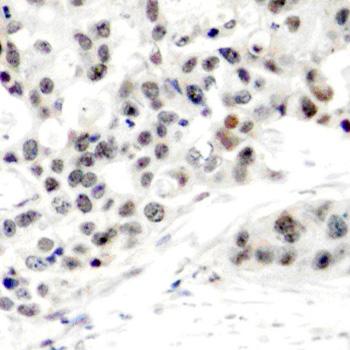 Immunohistochemistry (Formalin/PFA-fixed paraffin-embedded sections) - Anti-Estrogen Receptor alpha (phospho S106) antibody (AB194784)