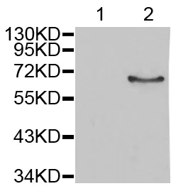 Western blot - Anti-Estrogen Receptor alpha (phospho S106) antibody (AB194784)