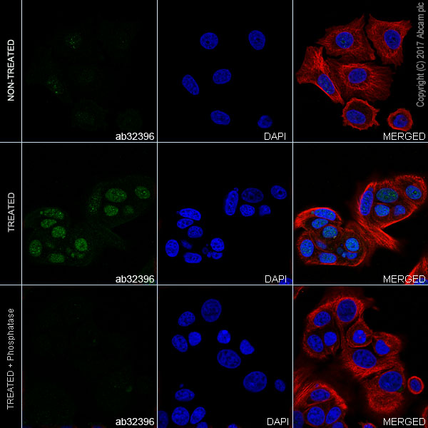 Immunocytochemistry/ Immunofluorescence - Anti-Estrogen Receptor alpha (phospho S118) antibody [E91] (AB32396), expandable thumbnail