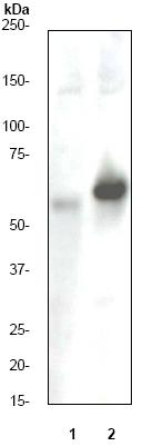 Western blot - Anti-Estrogen Receptor alpha (phospho S118) antibody [E91] (ab32396), expandable thumbnail