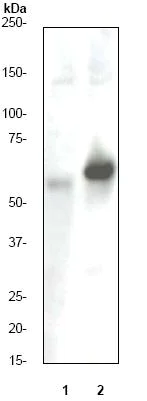 Western blot - Anti-Estrogen Receptor alpha (phospho S118) antibody [E91] (AB32396)