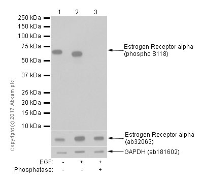 Western blot - Anti-Estrogen Receptor alpha (phospho S118) antibody [E91] (AB32396), expandable thumbnail