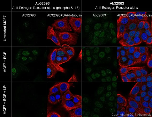 Immunocytochemistry/ Immunofluorescence - Anti-Estrogen Receptor alpha (phospho S118) antibody [E91] - BSA and Azide free (AB177817)