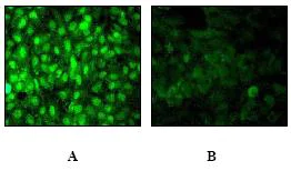 Immunocytochemistry/ Immunofluorescence - Anti-Estrogen Receptor alpha (phospho S118) antibody [E91] - BSA and Azide free (AB177817)